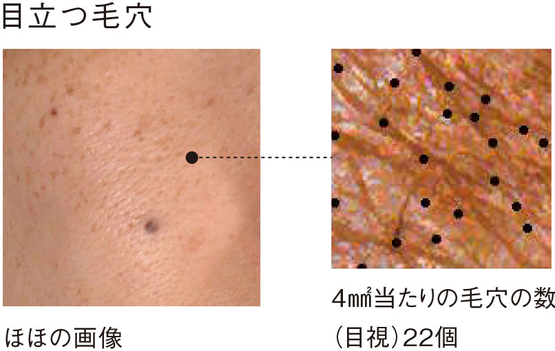 目立つ毛穴