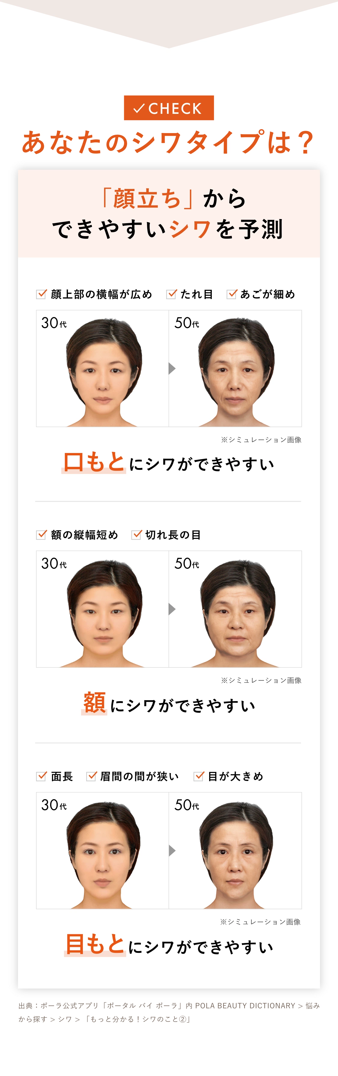 あなたのシワタイプは？