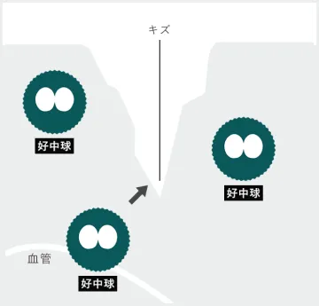 キズに集まる好中球