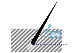 退行期