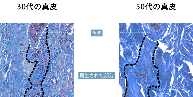 毛の根元周辺のコラーゲン状態