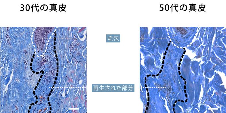 毛の根元周辺のコラーゲン状態