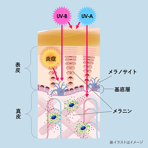 あらゆる刺激をもとに動き出すシミをつくるメカニズム。