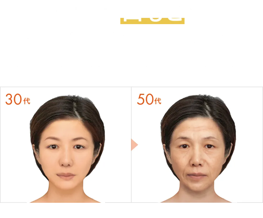 あなたは口もとにシワができやすいタイプです