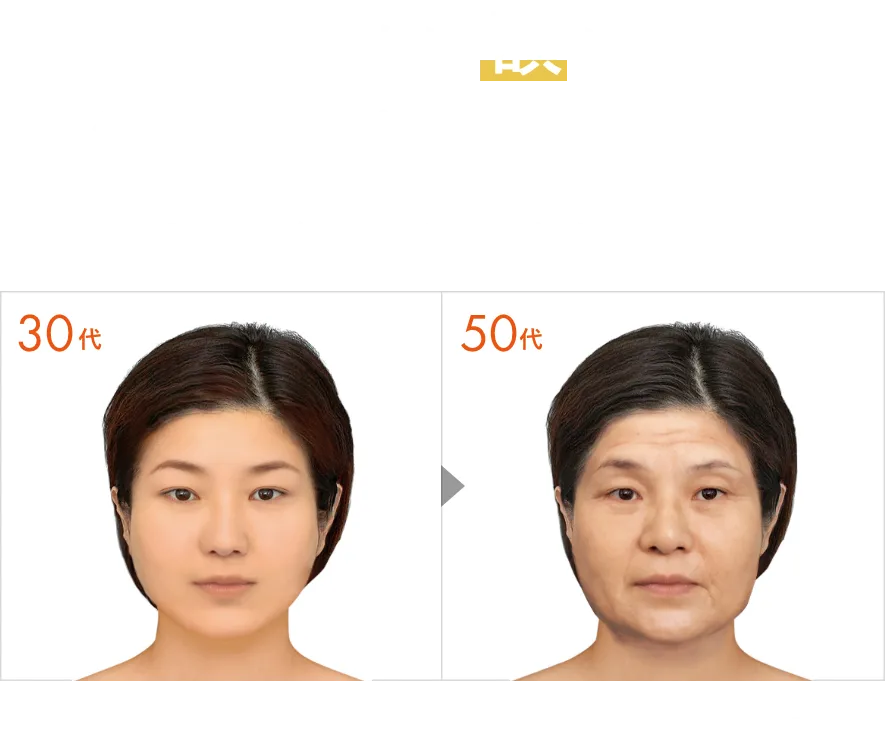あなたは額にシワができやすいタイプです