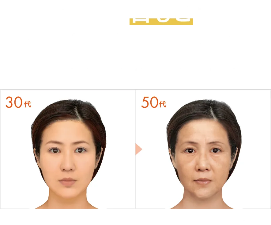 あなたは目もとにシワができやすいタイプです